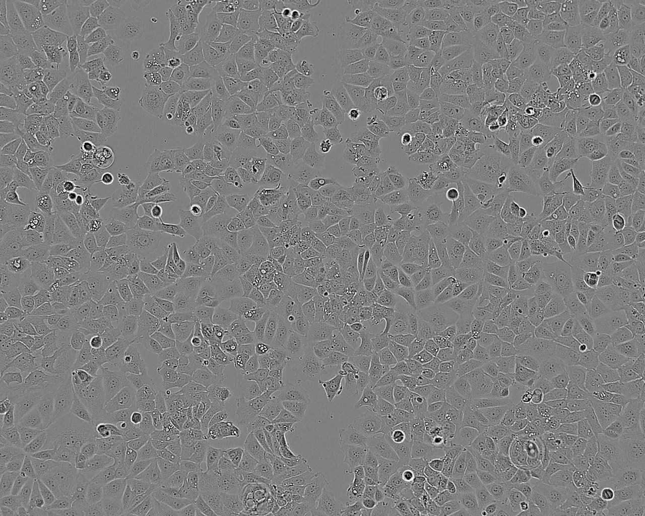 HBZY-1 epithelioid cells大鼠肾小球系膜细胞系,HBZY-1 epithelioid cells