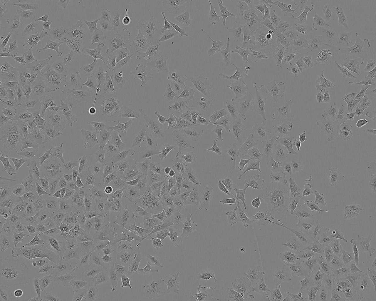 HOS epithelioid cells人骨肉瘤细胞系,HOS epithelioid cells