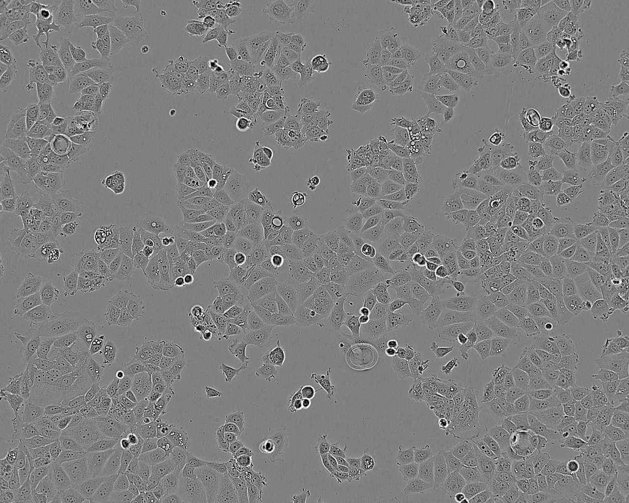 Hs 683 epithelioid cells人脑胶质瘤细胞系,Hs 683 epithelioid cells