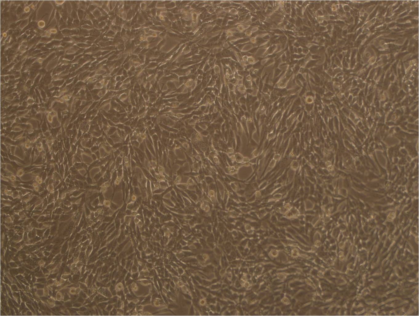 MDA-MB-361 epithelioid cells人乳腺癌细胞系,MDA-MB-361 epithelioid cells