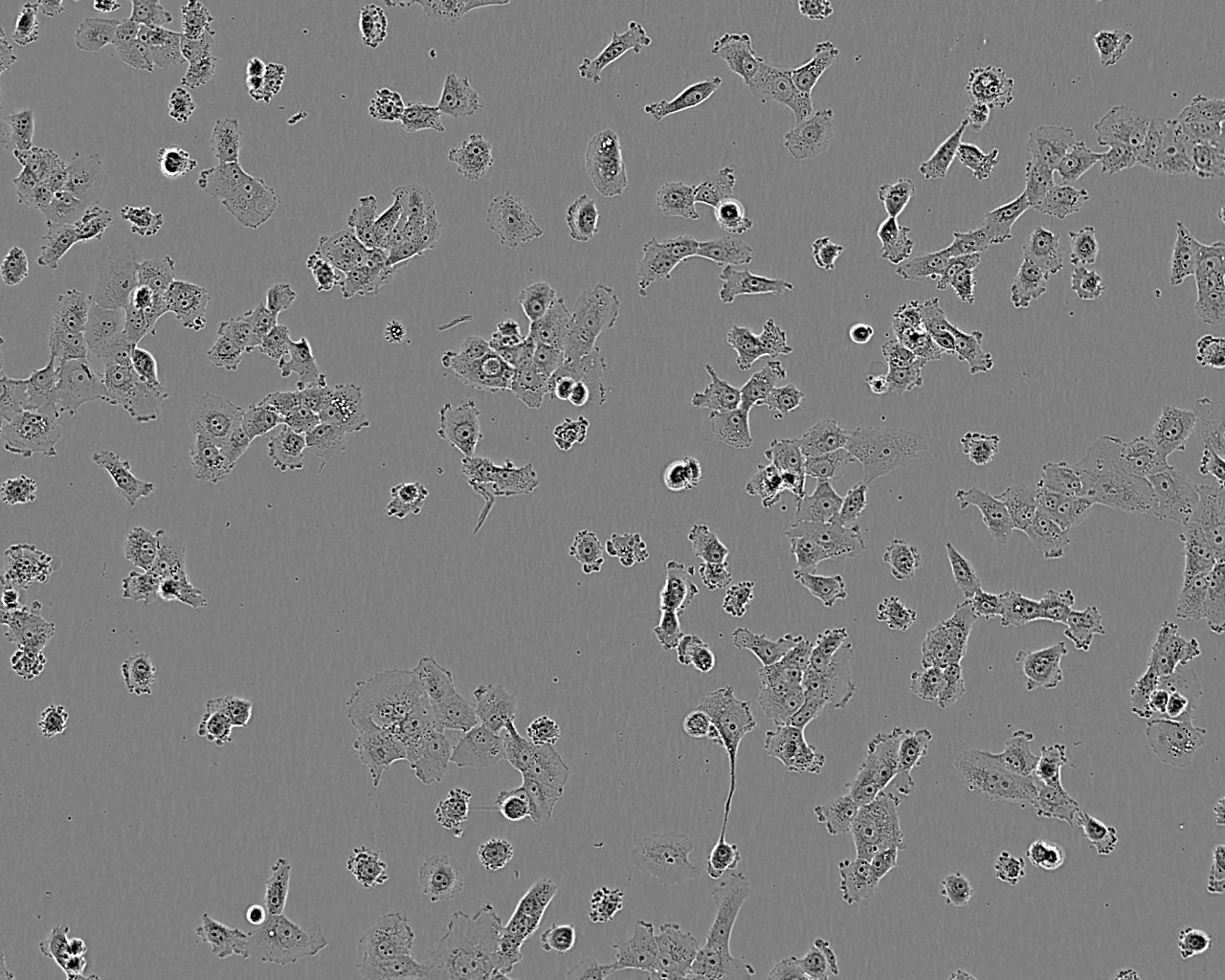 HCC1806 epithelioid cells人乳腺鳞状癌细胞系,HCC1806 epithelioid cells