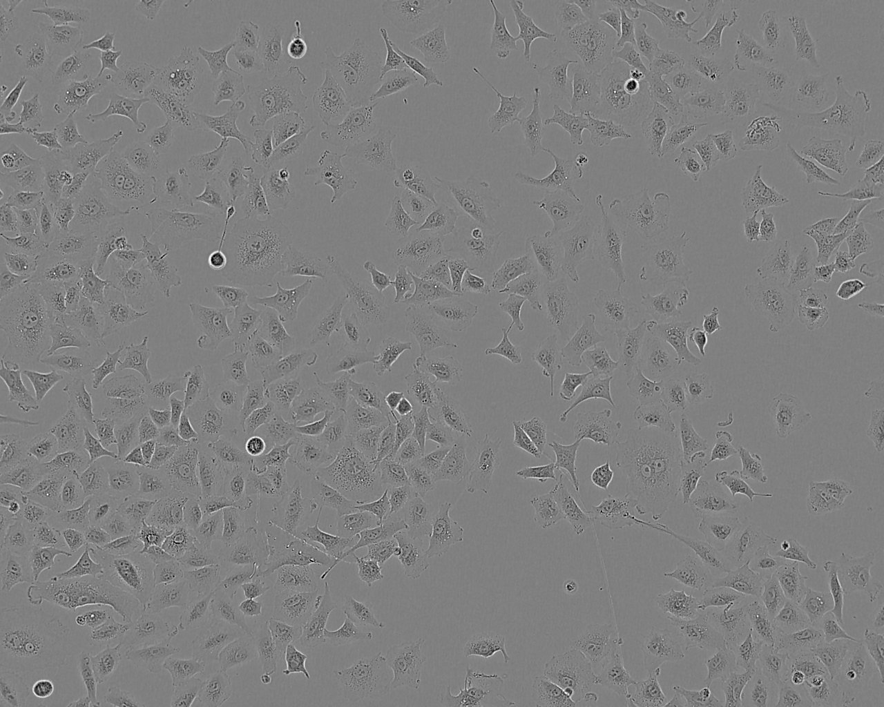 HCC70 epithelioid cells人乳腺导管癌细胞系,HCC70 epithelioid cells