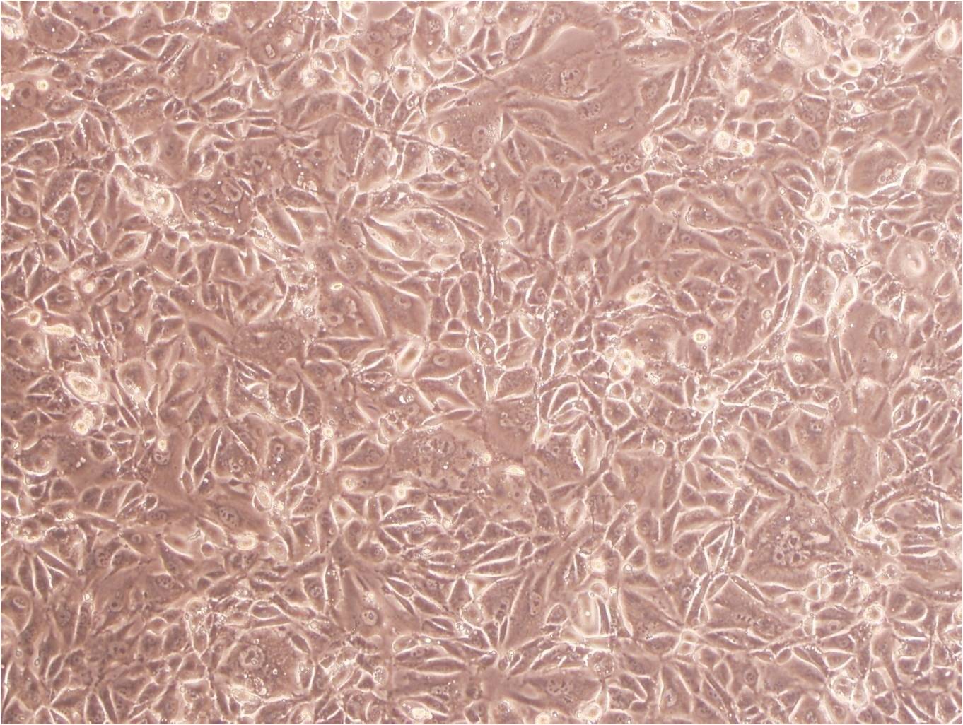 HCC1937 epithelioid cells人乳腺癌细胞系,HCC1937 epithelioid cells