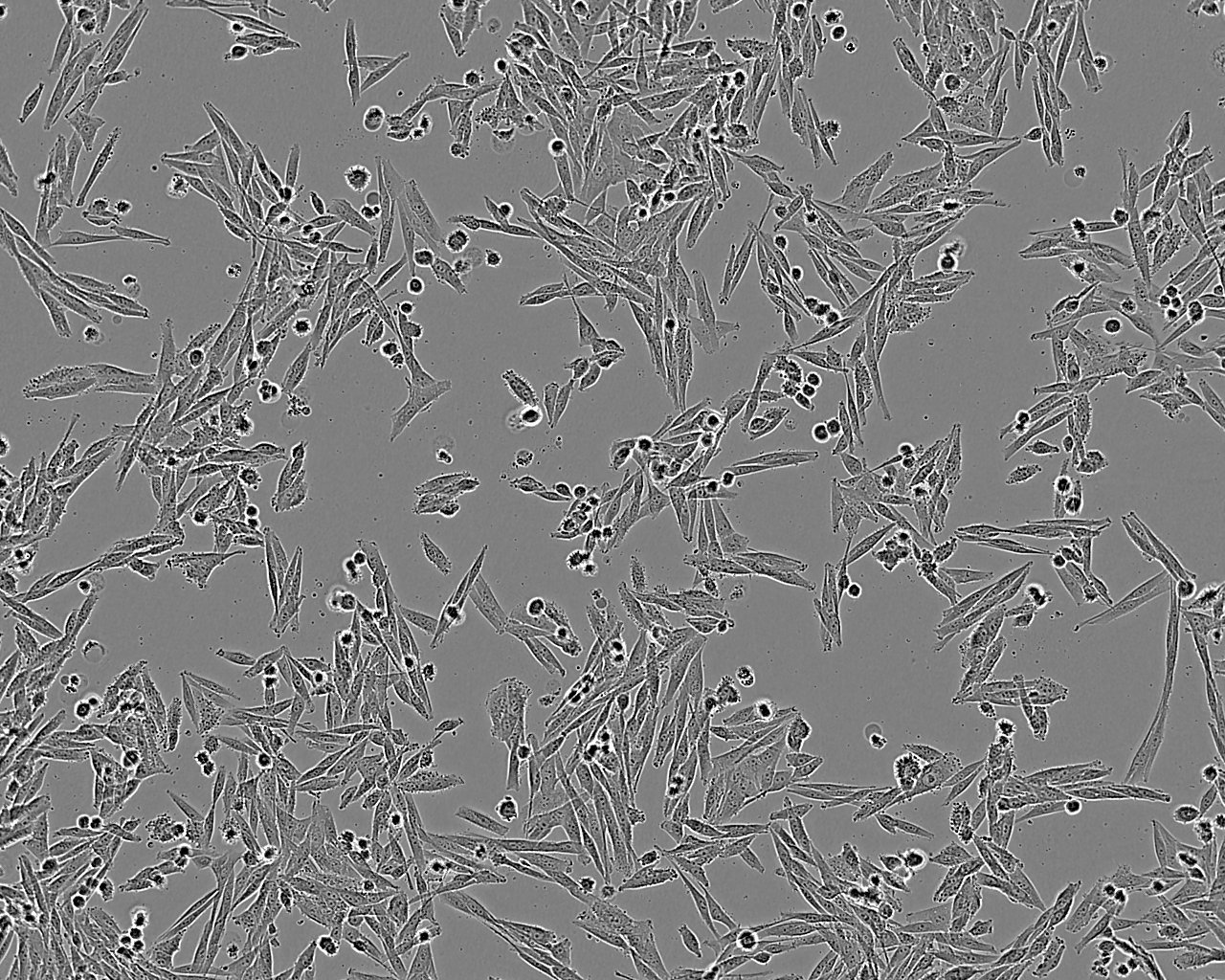 DoTc2 4510 epithelioid cells人子宫颈癌细胞系,DoTc2 4510 epithelioid cells