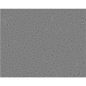 LoVo epithelioid cells人结肠癌细胞系