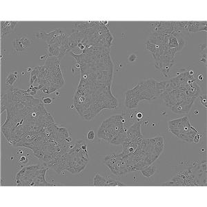 MeT-5A epithelioid cells人膜間皮細胞系