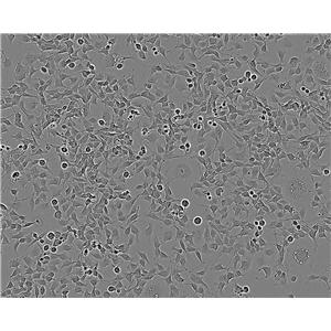 MHCC97-H epithelioid cells高转移人肝癌细胞系