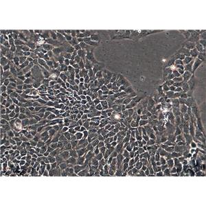 THLE-3 epithelioid cells人肝永生化細(xì)胞系,THLE-3 epithelioid cells