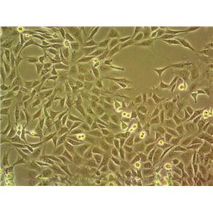 KLE epithelioid cells人子宫内膜癌细胞系