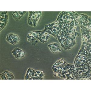 HEC-1-A epithelioid cells人子宫内膜癌细胞系