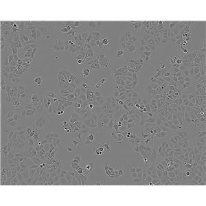 Daoy epithelioid cells人脑髓母细胞瘤细胞系