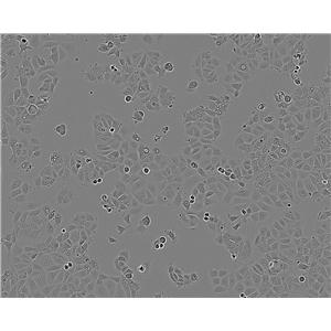 MDA-MB-175-VII epithelioid cells人乳腺导管癌细胞系