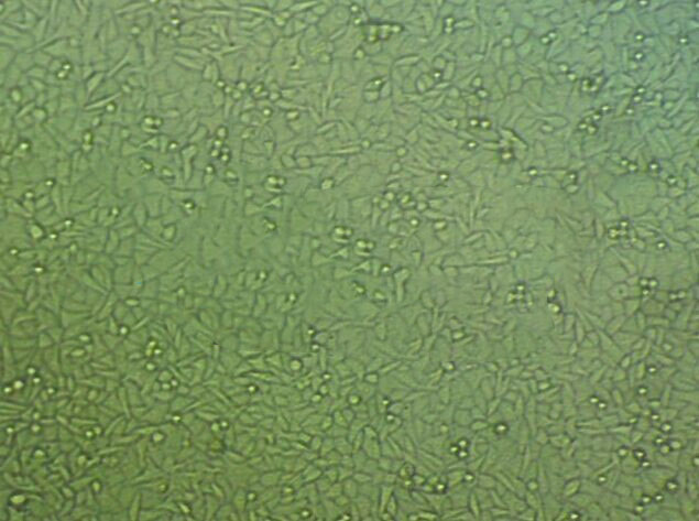 LS513 epithelioid cells人盲腸癌細(xì)胞系,LS513 epithelioid cells