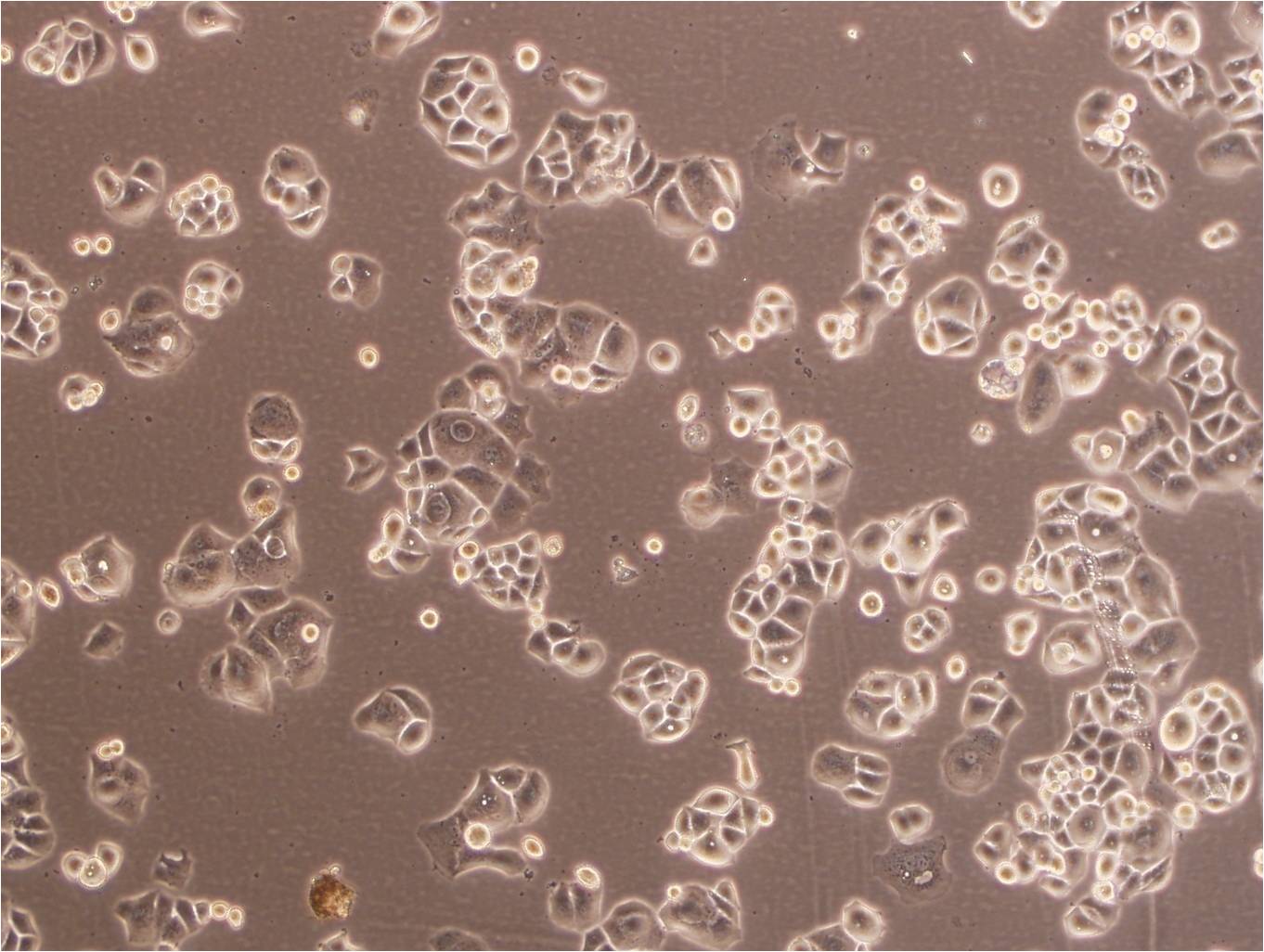 F-36P epithelioid cells骨髓增生异常综合征细胞系,F-36P epithelioid cells