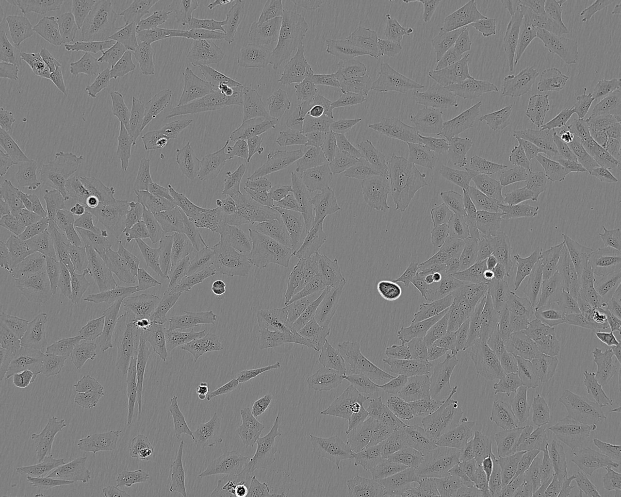 SK-LU-1 epithelioid cells人低分化肺腺癌细胞系,SK-LU-1 epithelioid cells