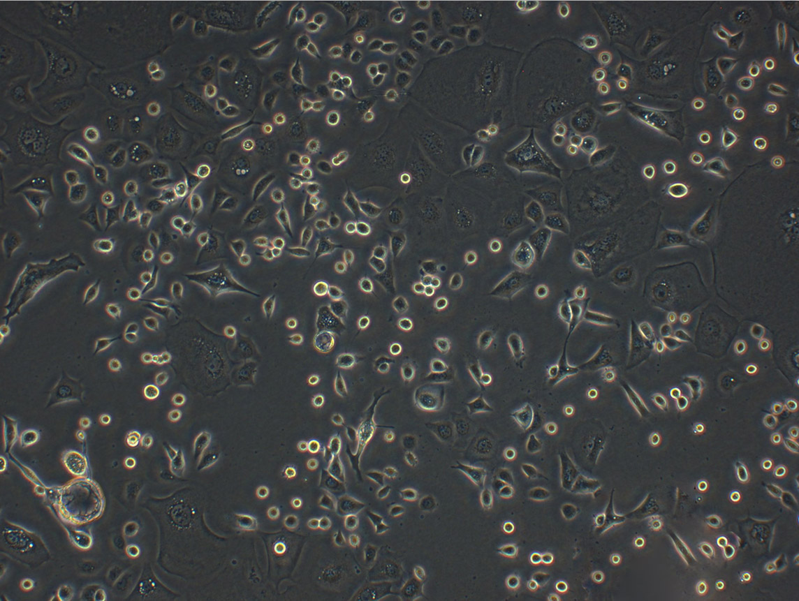 NCI-H1666 epithelioid cells人肺支气管癌细胞系,NCI-H1666 epithelioid cells