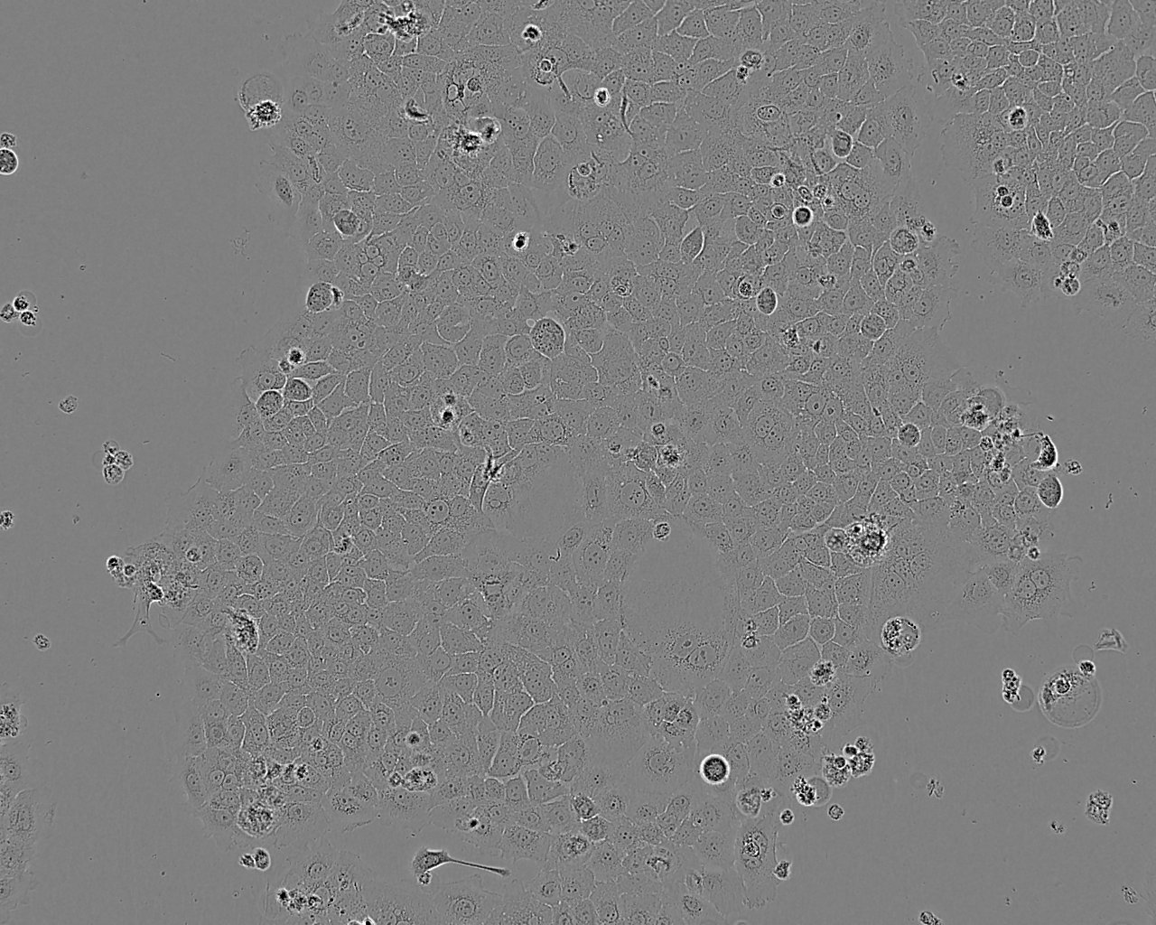 NCI-H2073 epithelioid cells人非小细胞肺癌细胞系,NCI-H2073 epithelioid cells