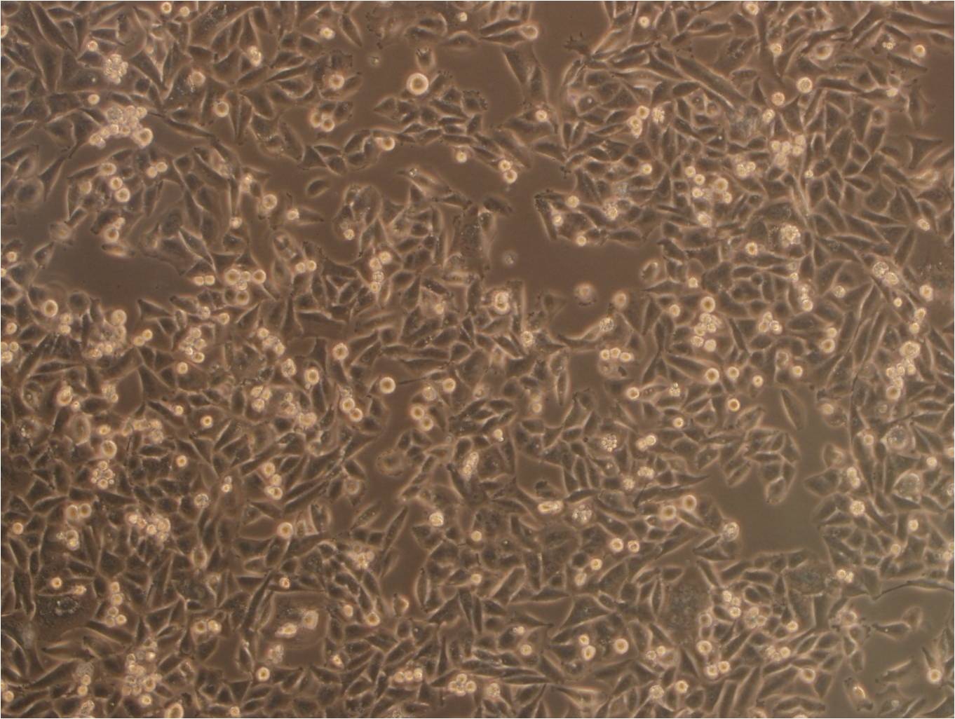 NCI-H2342 epithelioid cells人非小细胞肺癌细胞系,NCI-H2342 epithelioid cells