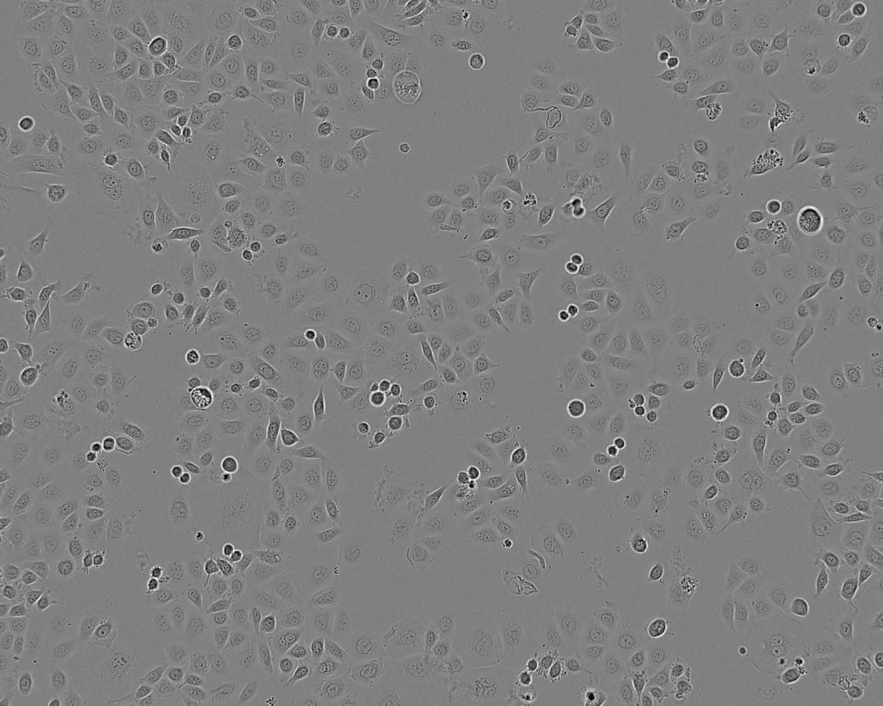 NCI-H1993 epithelioid cells人肺癌細(xì)胞系,NCI-H1993 epithelioid cells