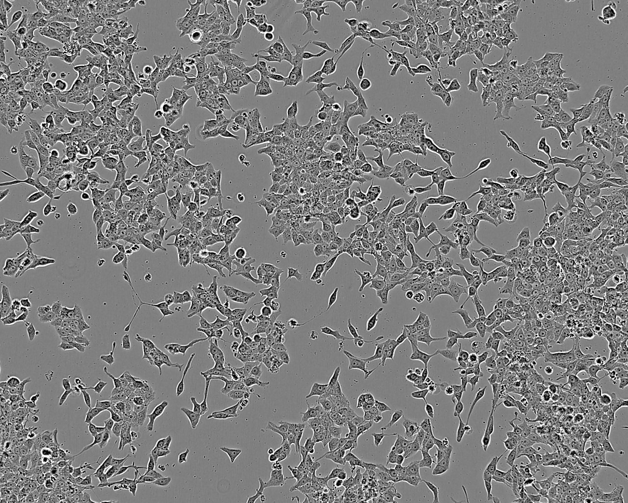 NCI-H209 epithelioid cells人小细胞肺癌细胞系,NCI-H209 epithelioid cells