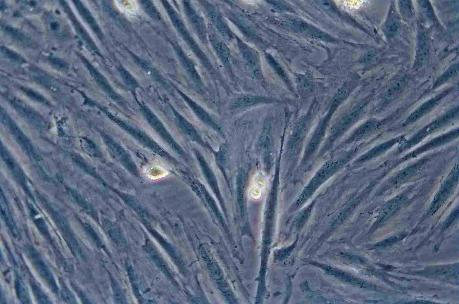 BALB/3T3 clone A31 Cell:小鼠胚胎成纤维细胞系,BALB/3T3 clone A31 Cell
