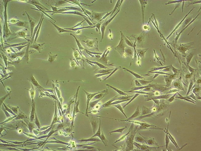 HFLS-RA Cell:类风湿关节炎成纤维样滑膜细胞系,HFLS-RA Cell