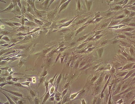 CCD-19Lu Cell:人肺成纤维细胞系,CCD-19Lu Cell