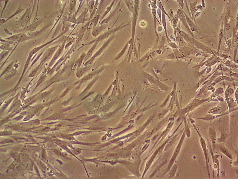 HPAF Cell:人肺動(dòng)脈成纖維細(xì)胞系,HPAF Cell