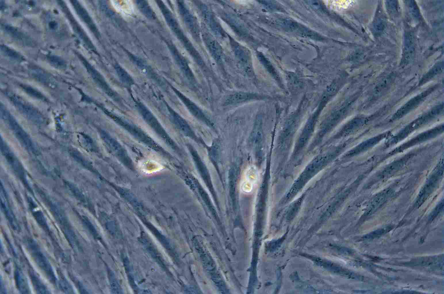 NCTC clone 929 Cell:小鼠成纤维细胞系,NCTC clone 929 Cell