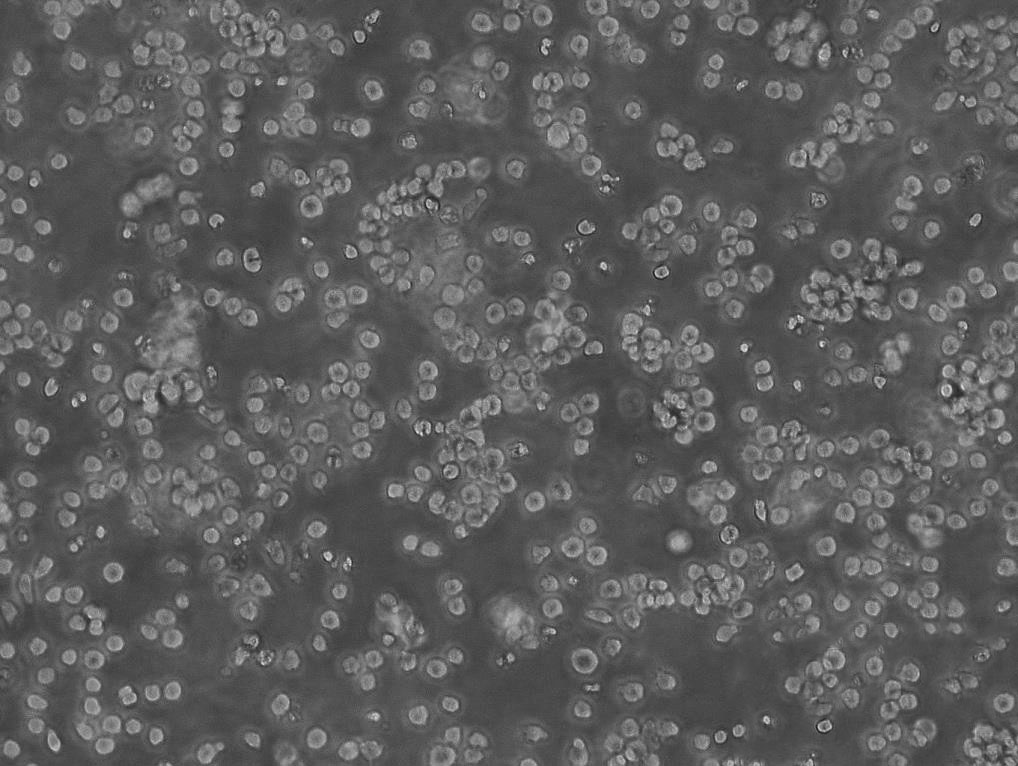 P388 Cell:小鼠白血病細胞系,P388 Cell