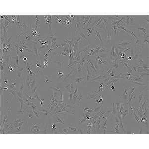 CCD-18Co Cell:正常人结肠成纤维细胞系