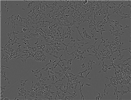 RASMC Cell:大鼠主动脉平滑肌细胞系