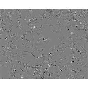 GM00637 Cell:人皮肤成纤维细胞系,GM00637 Cell
