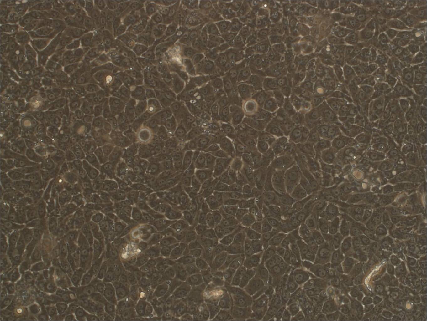 201T epithelioid cells人肺腺癌细胞系,201T epithelioid cells