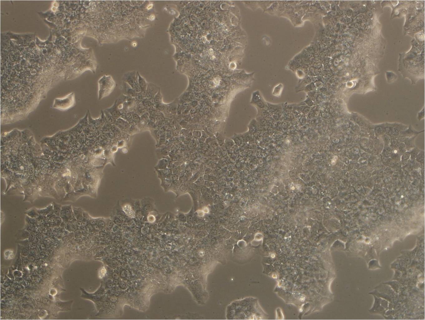 Caov-4 epithelioid cells人卵巢癌细胞系,Caov-4 epithelioid cells