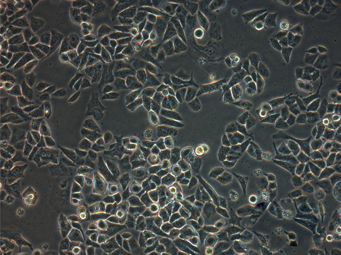 HCE-T epithelioid cells人角膜上皮细胞系,HCE-T epithelioid cells