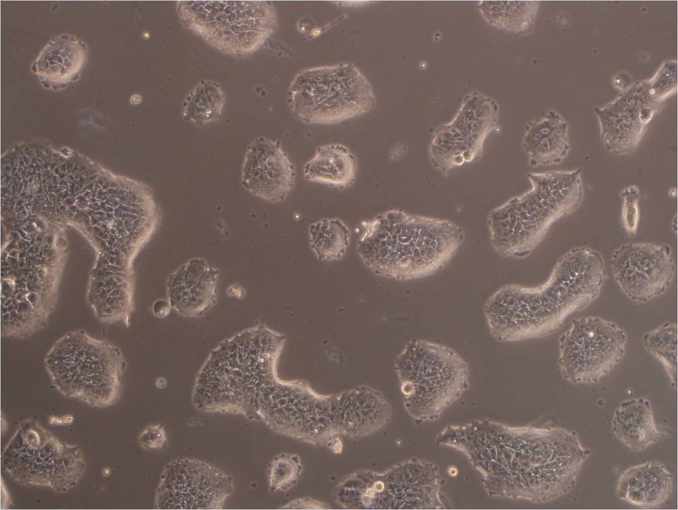 ECC-1 epithelioid cells人子宫内膜腺癌细胞系,ECC-1 epithelioid cells