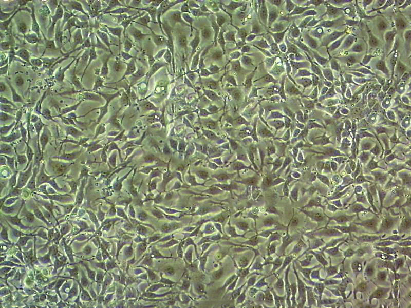 NCI-H2066 epithelioid cells人肺癌细胞系,NCI-H2066 epithelioid cells