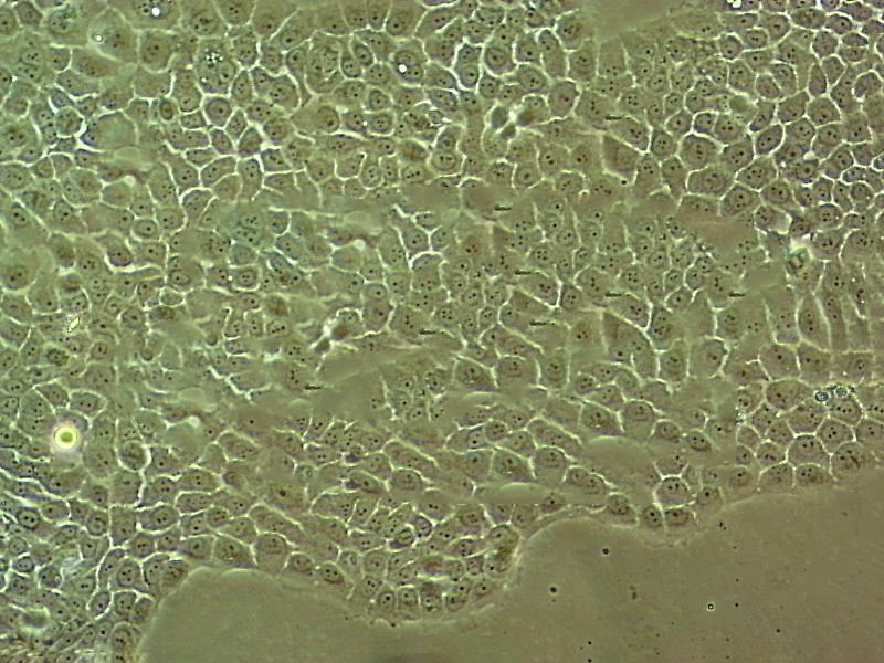 A2058 epithelioid cells人黑色素瘤细胞系,A2058 epithelioid cells