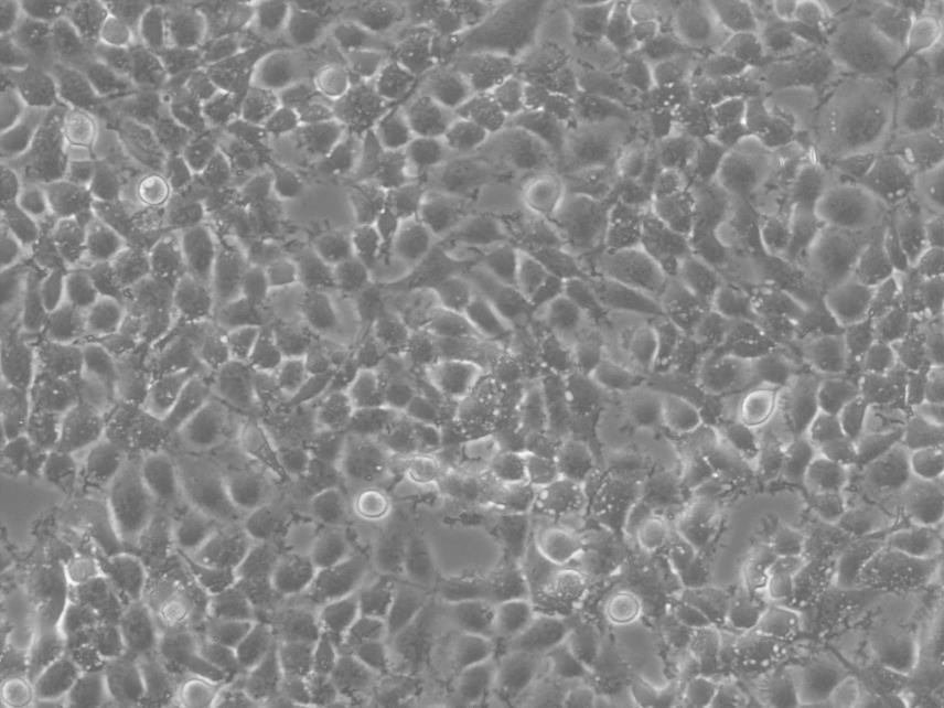 SCC-25 epithelioid cells人口腔鳞癌细胞系,SCC-25 epithelioid cells