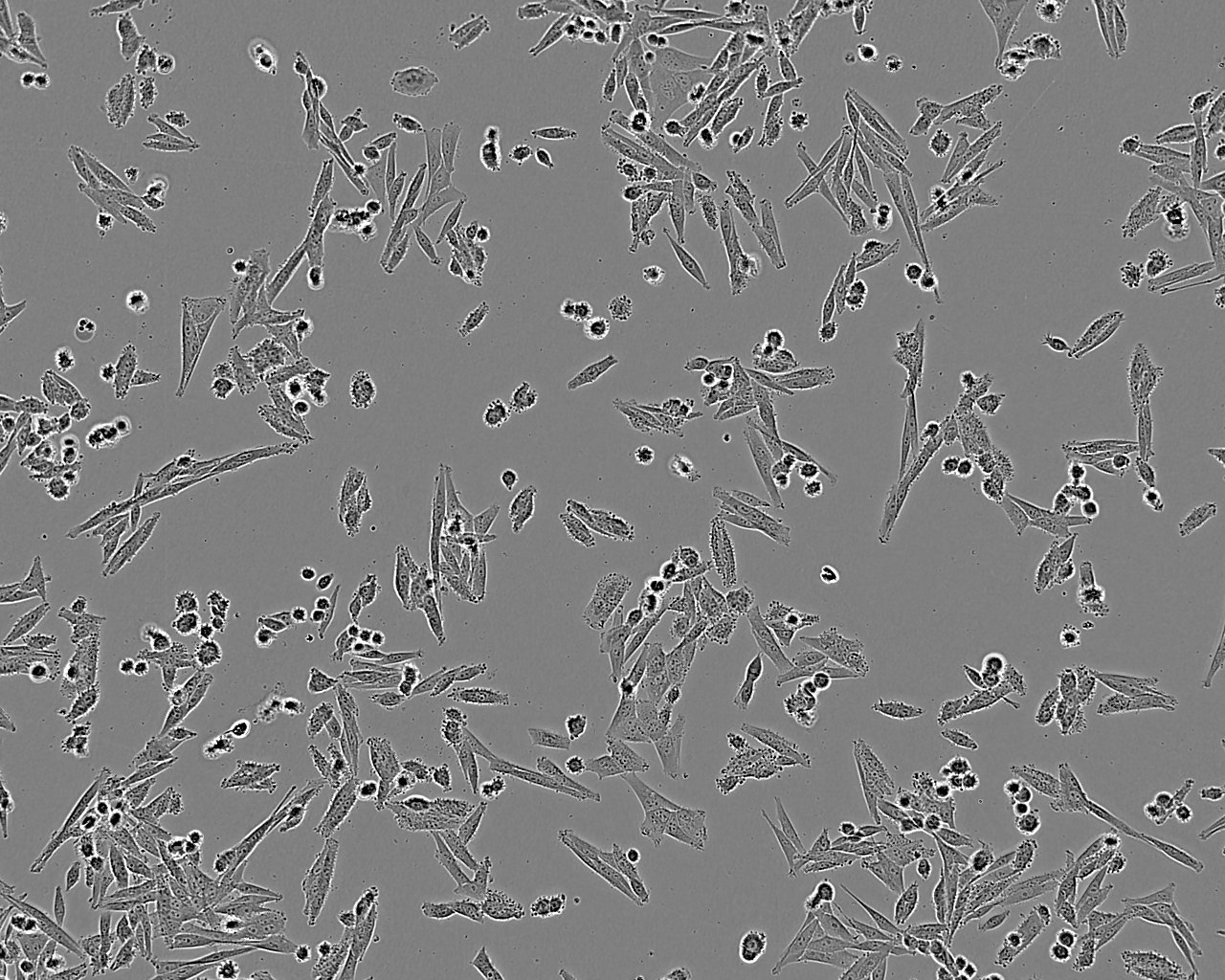 SNG-M epithelioid cells人子宫内膜癌细胞系,SNG-M epithelioid cells