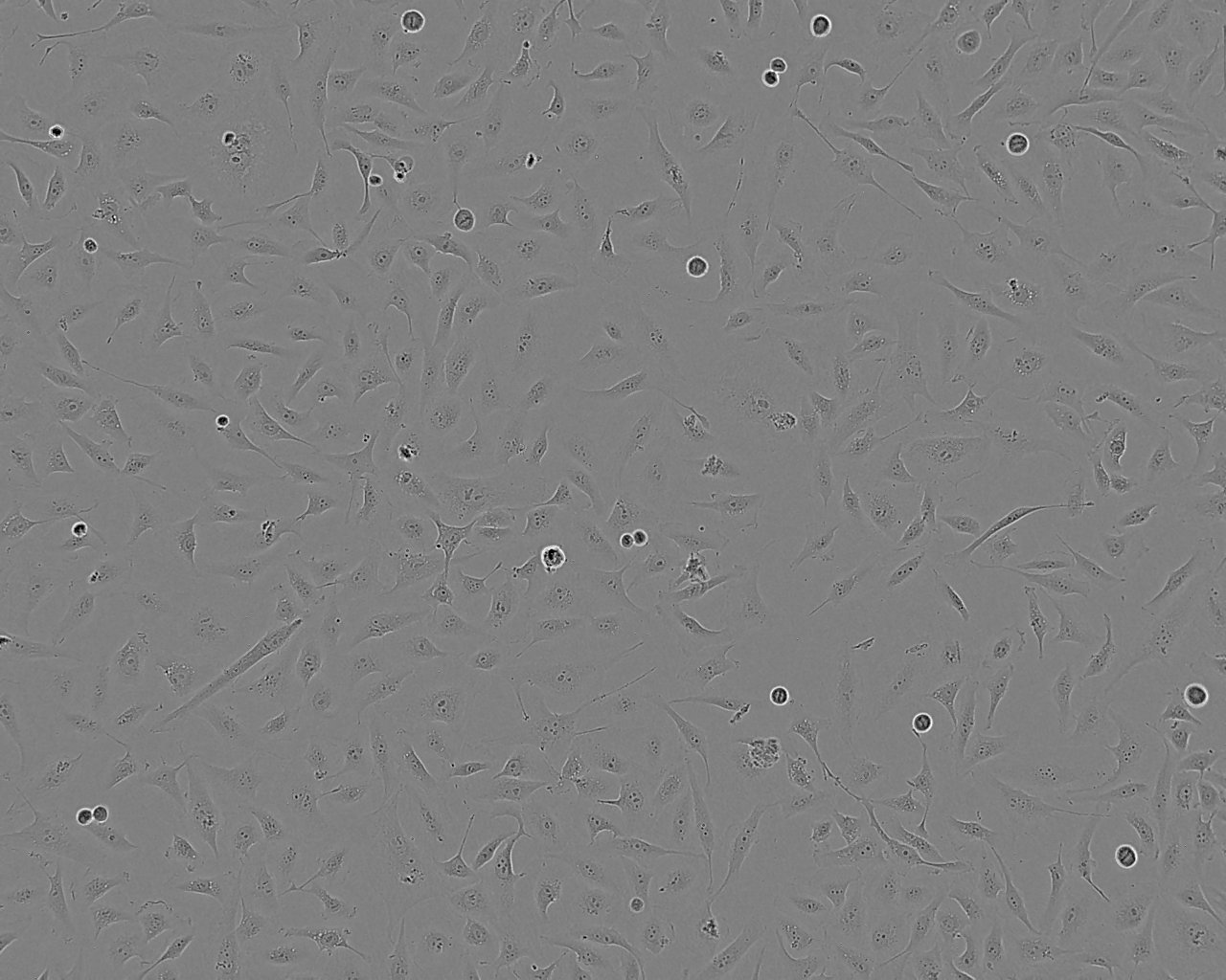 Ca9-22 epithelioid cells人口腔上皮癌細胞系,Ca9-22 epithelioid cells