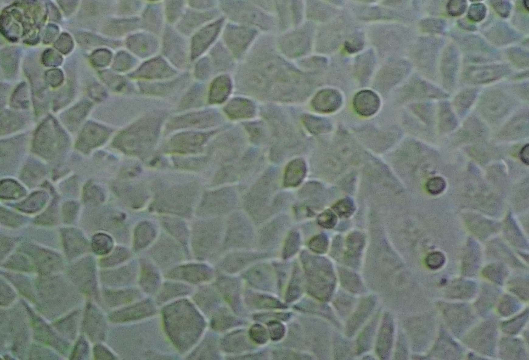 Caov-3 epithelioid cells人卵巢癌细胞系,Caov-3 epithelioid cells