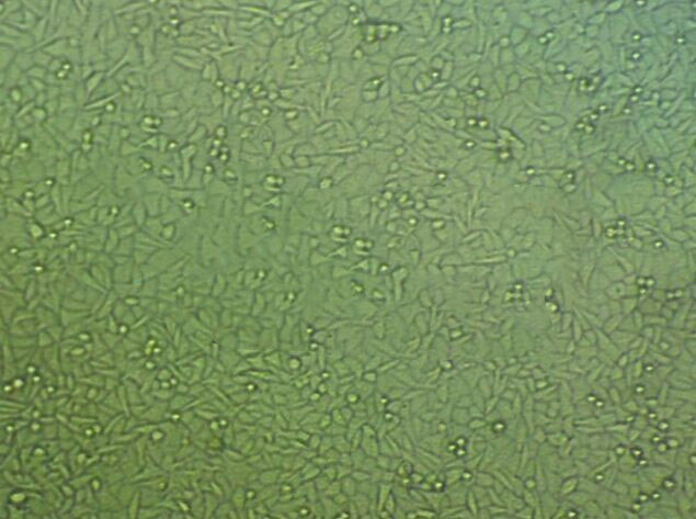 M14 epithelioid cells人黑色素瘤细胞系,M14 epithelioid cells