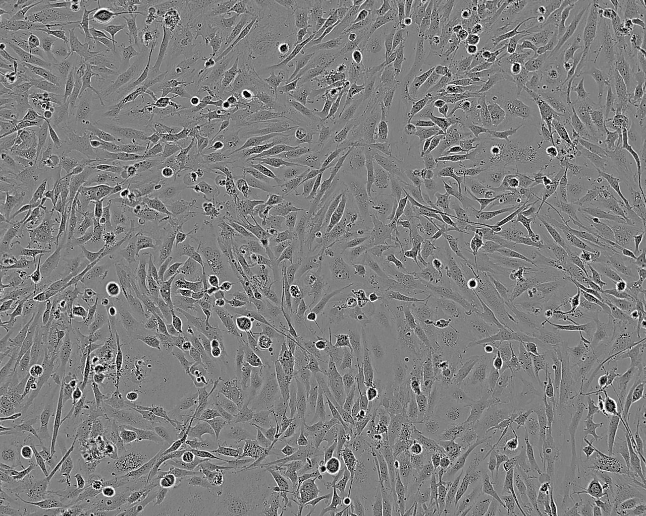 NCI-ADR-RES epithelioid cells卵巢腺癌细胞系,NCI-ADR-RES epithelioid cells