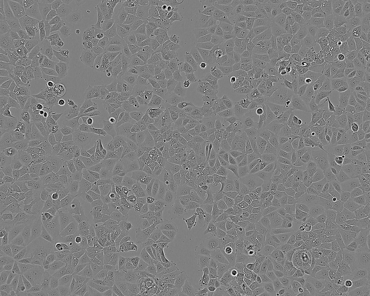 Onda 11 epithelioid cells人脑神经胶质瘤细胞系,Onda 11 epithelioid cell