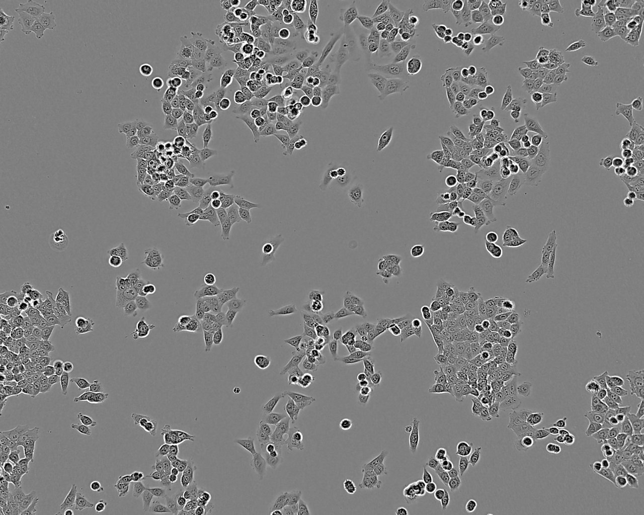 PE/CA-PJ34 (clone C12) epithelioid cells人口腔鱗狀細(xì)胞癌細(xì)胞系,PE/CA-PJ34 (clone C12) epithelioid cells