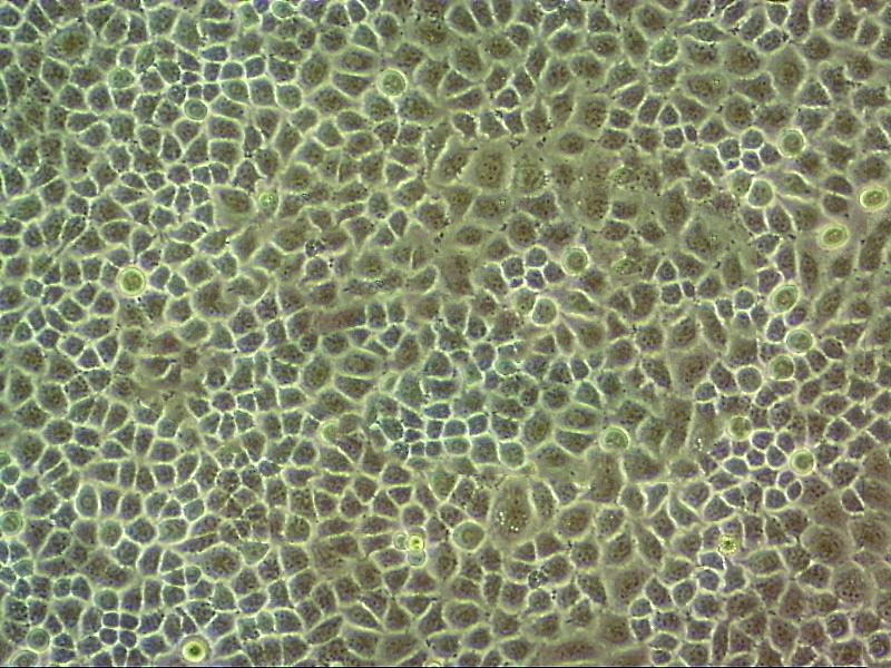 SAS epithelioid cells人舌鳞状细胞癌细胞系,SAS epithelioid cells