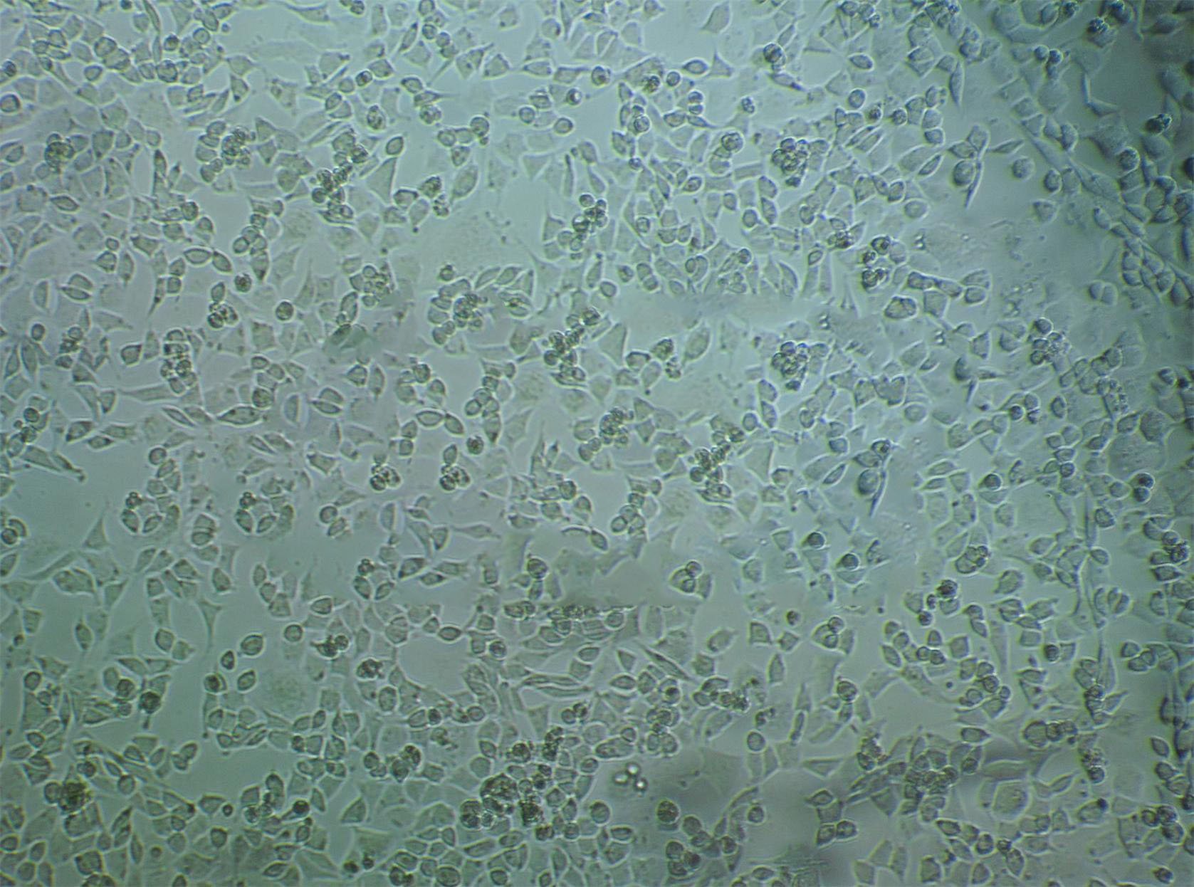 SKG-IIIa epithelioid cells人宫颈癌细胞系,SKG-IIIa epithelioid cells