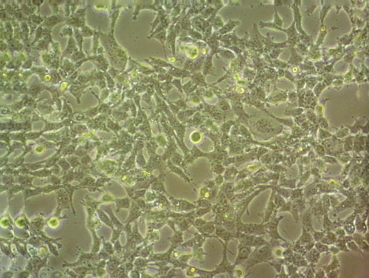 SNU-354 epithelioid cells人肝癌细胞系,SNU-354 epithelioid cells